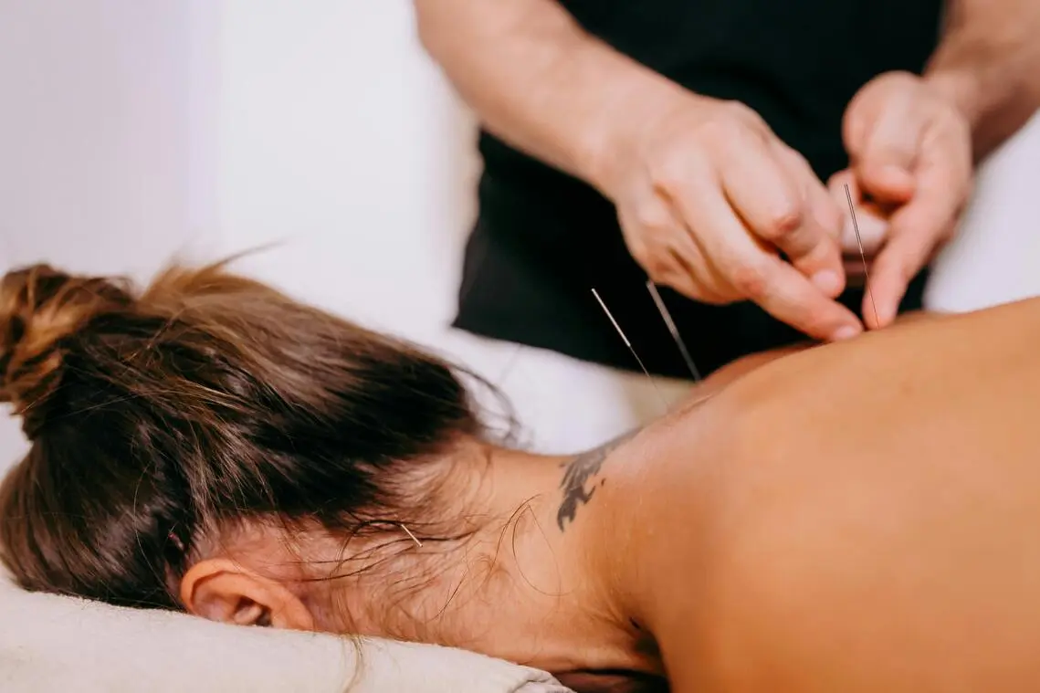 Imagen de una persona haciendo acupuntura